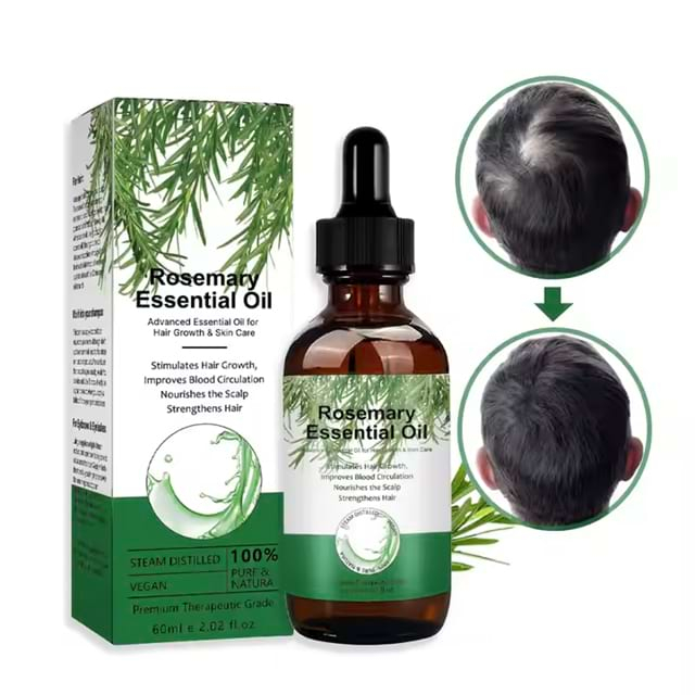 OEM Natural Herbal Organic Rosemary Fast Hair Growth Serum For Hair Loss Treatment Hair Growth Oil For Black Women Private Label