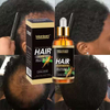 OEM 100ml Men Women Hair Loss Treatment Private Label Organic Hair Growth Serum Natural Herbal Care Rapid Hair Growth Oil