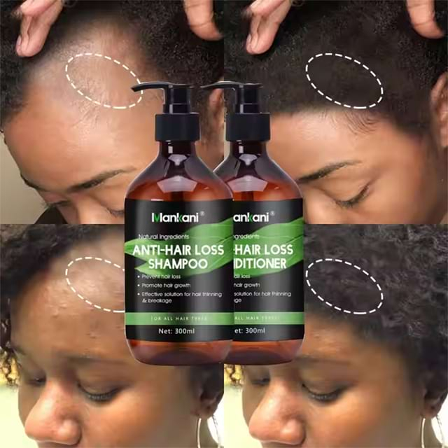 Mankani 300ml Bottle Healthy Herbal Organic Thickening Ginger Care Hair Loss Treatment Oil Control Hair Shampoo And Conditioner