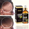 OEM 100ml Men Women Hair Loss Treatment Private Label Organic Hair Growth Serum Natural Herbal Care Rapid Hair Growth Oil